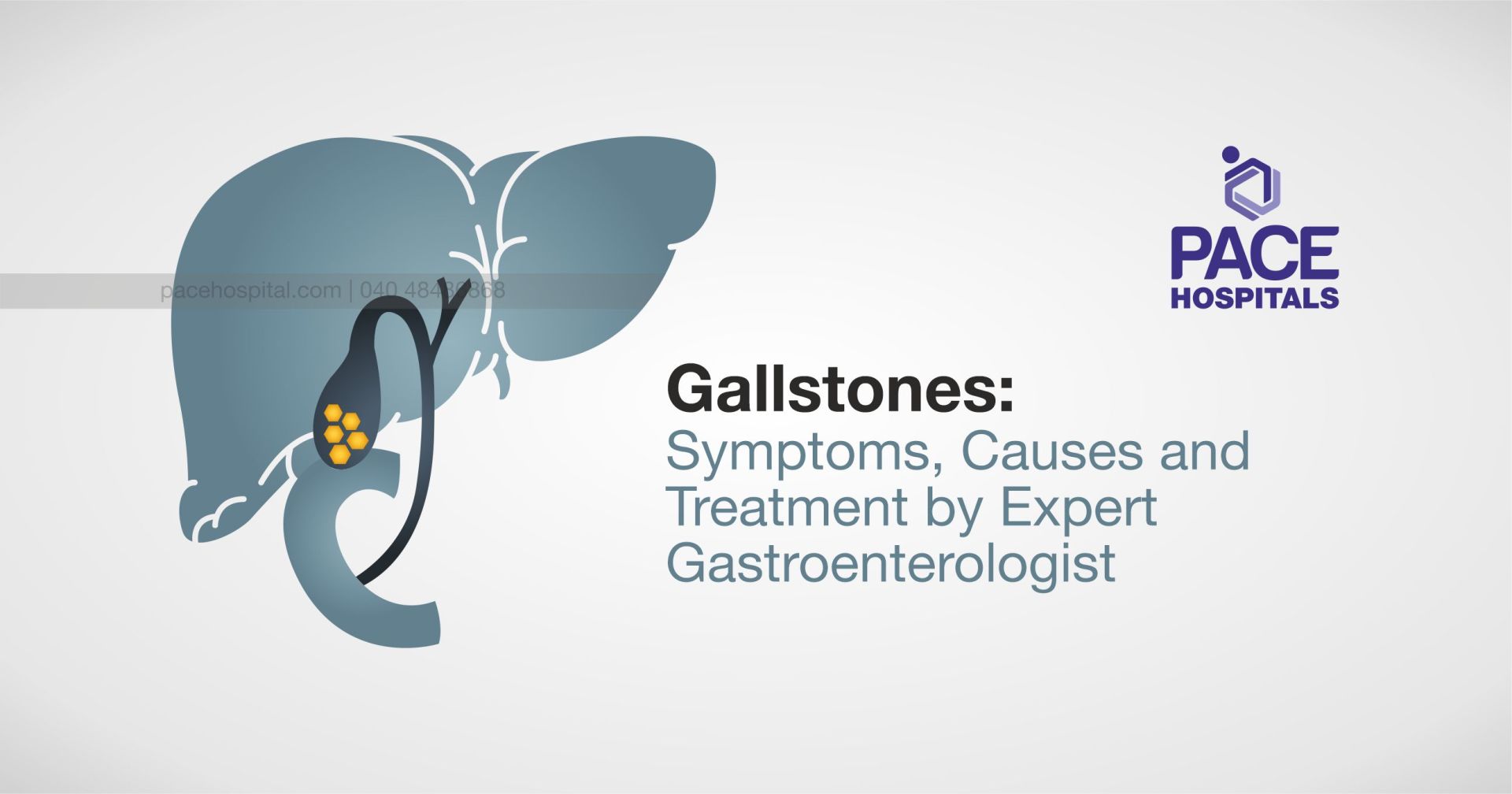 Gallstones Symptoms, Causes and Treatment by Best Gastroenterologist