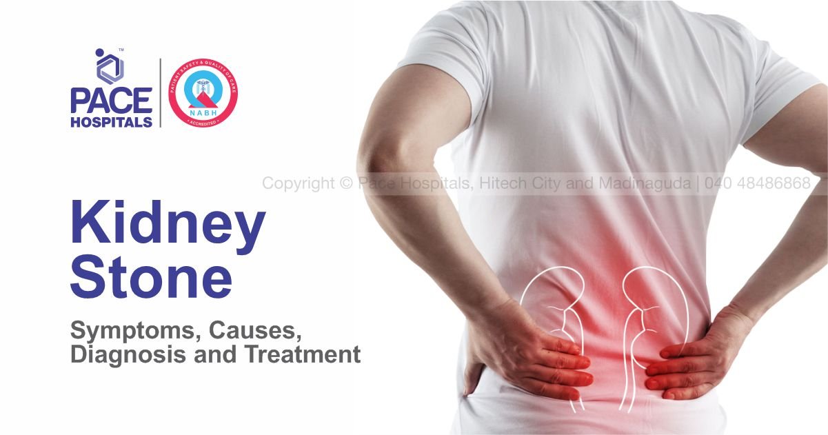 kidney-stone-causes-symptoms-diagnosis-and-treatment