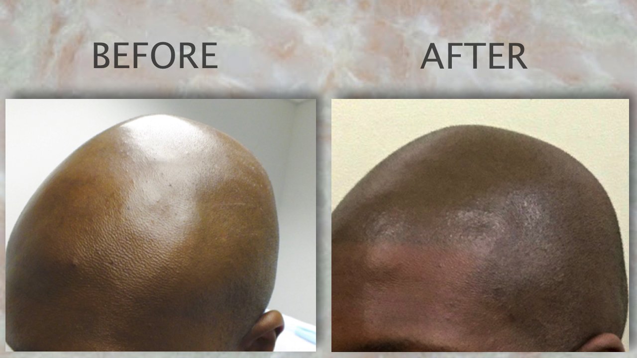 The Science Behind the Suds (or Lack Thereof)