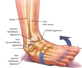Ankle Sprain | Ankle | Dr Ben Beamond | Adelaide