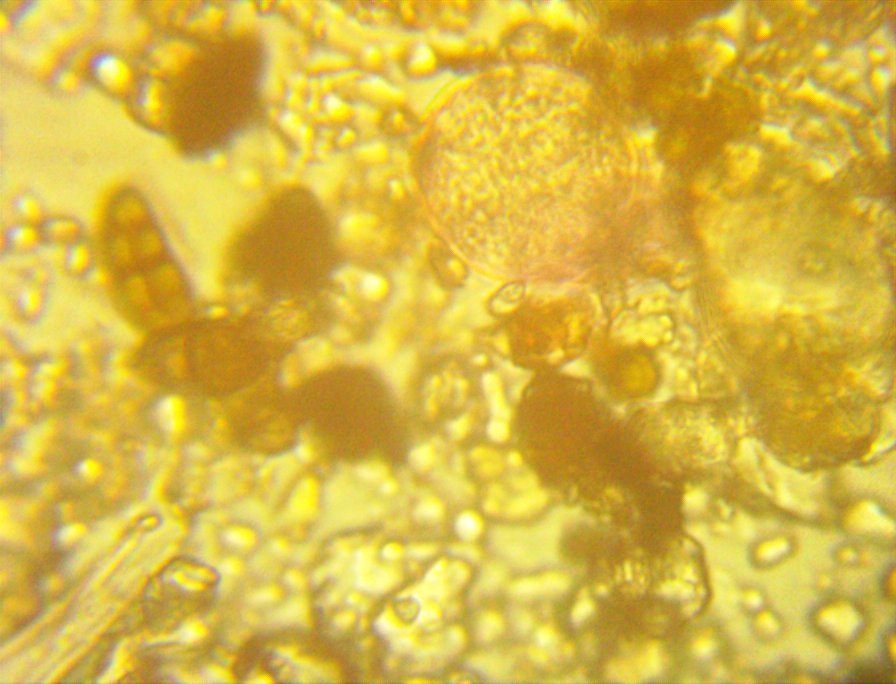 Grand Junction Pollen Count