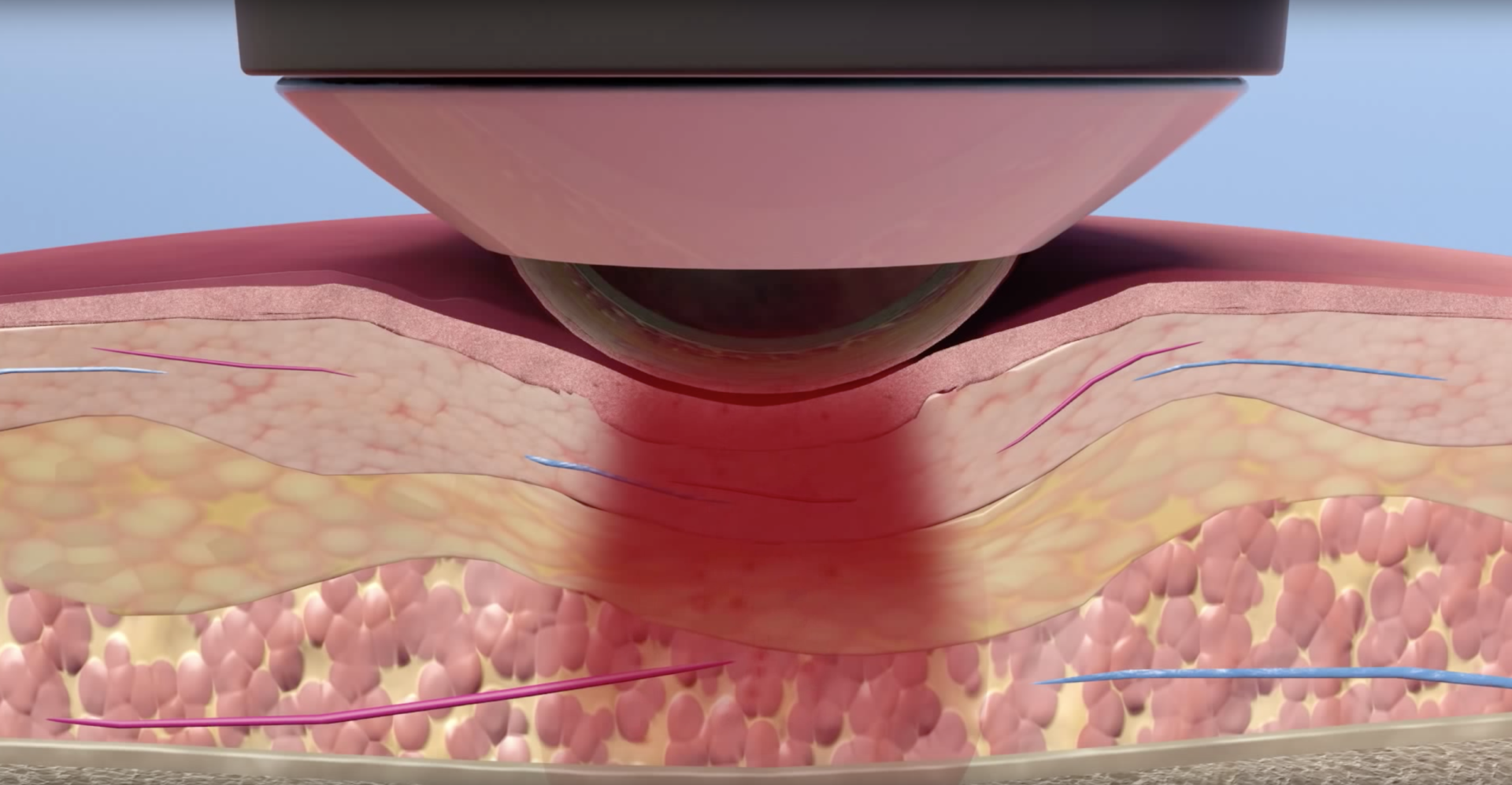 The Amazing Healing Power of Class IV Deep Tissue Laser Therapy.