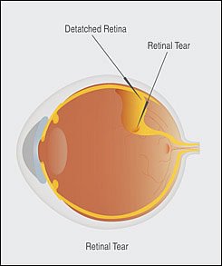  eye and sends visual messages through the optic nerve to the brain