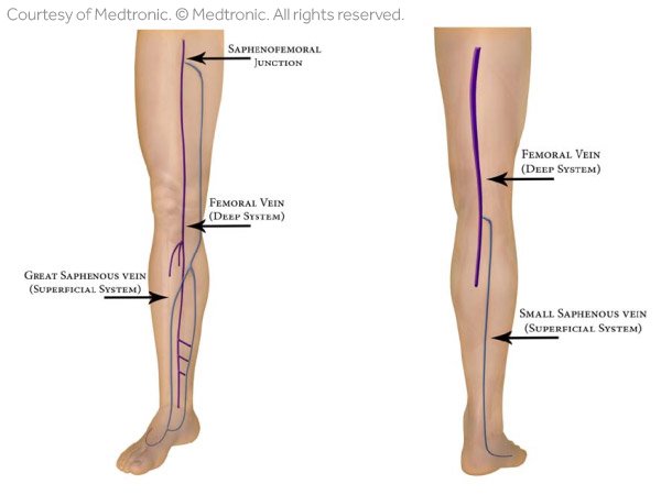 Leg Vein Diagram Illustration 