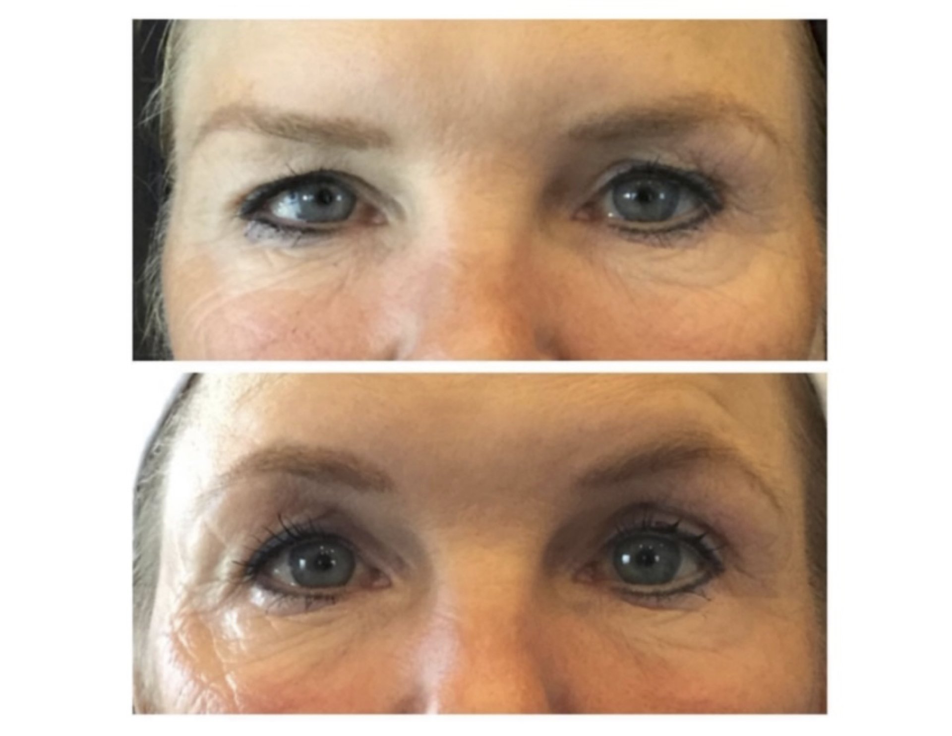 Chicago Laser Skin Rejuvenation Specialist Dr. Yates Lifestyle Med