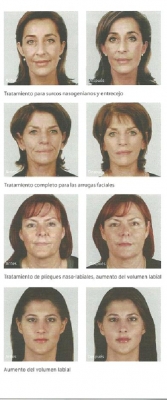 Dr. Alejandro Medrano Dermatología Estética y Láser