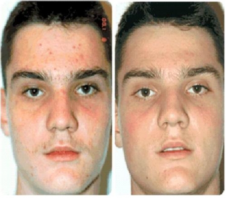 Dr. Alejandro Medrano Dermatología Estética y Láser