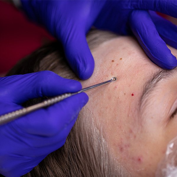 Patient Registration Metairie, LA Dr. Carter D. Paddock