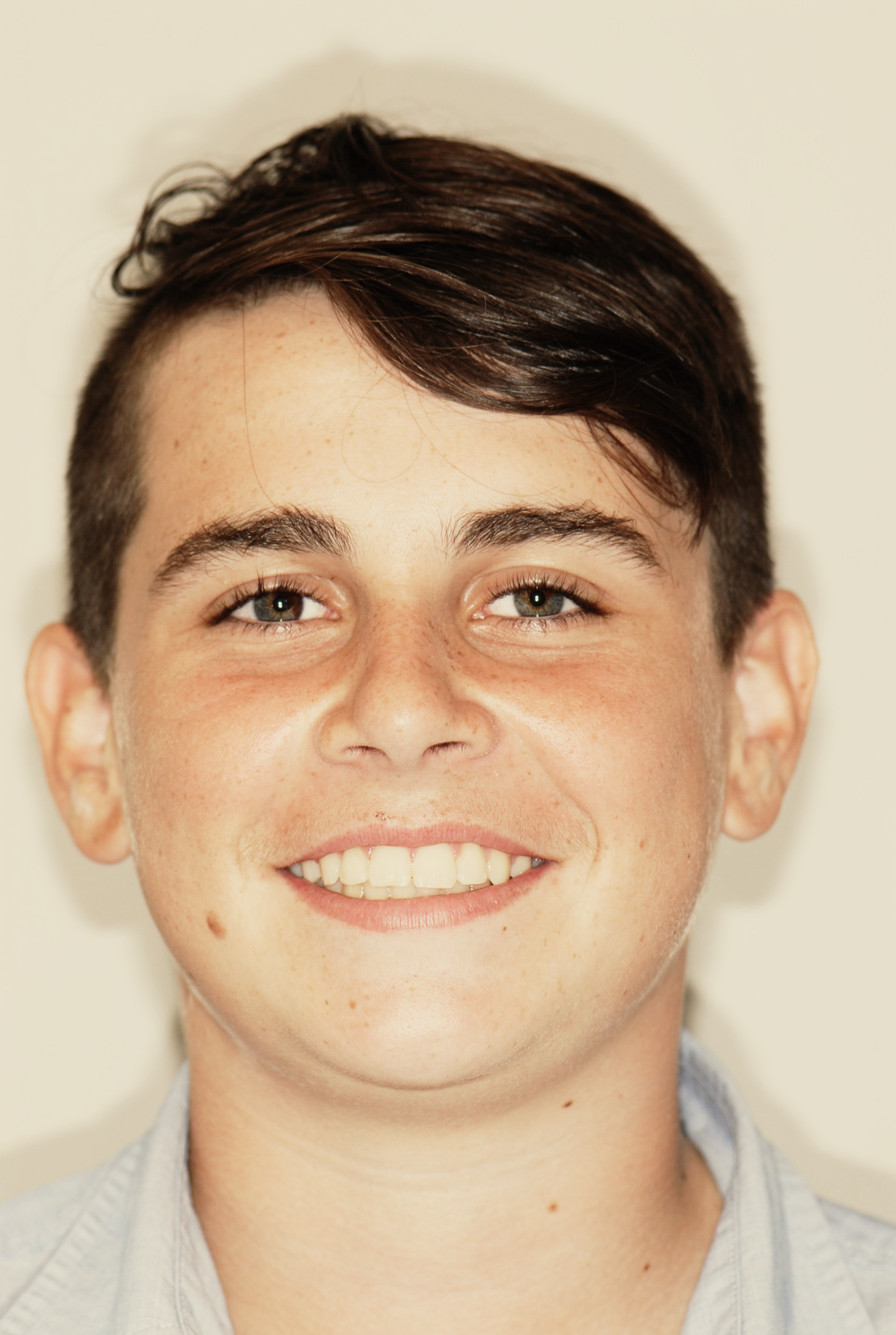 Boy smiling - teeth whitening Christchurch - Duxton Dental