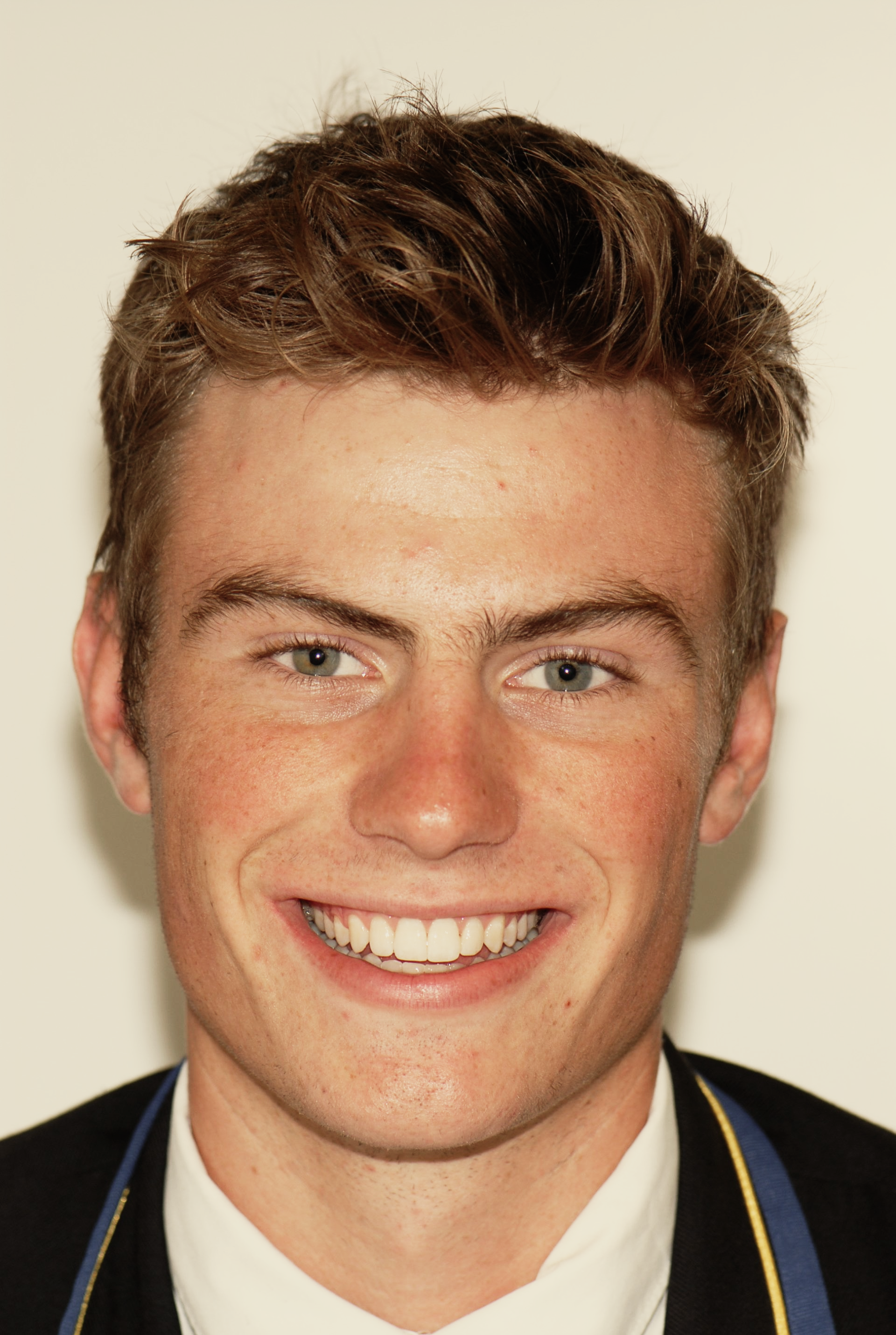 Boy smiling - teeth whitening Christchurch - Duxton Dental