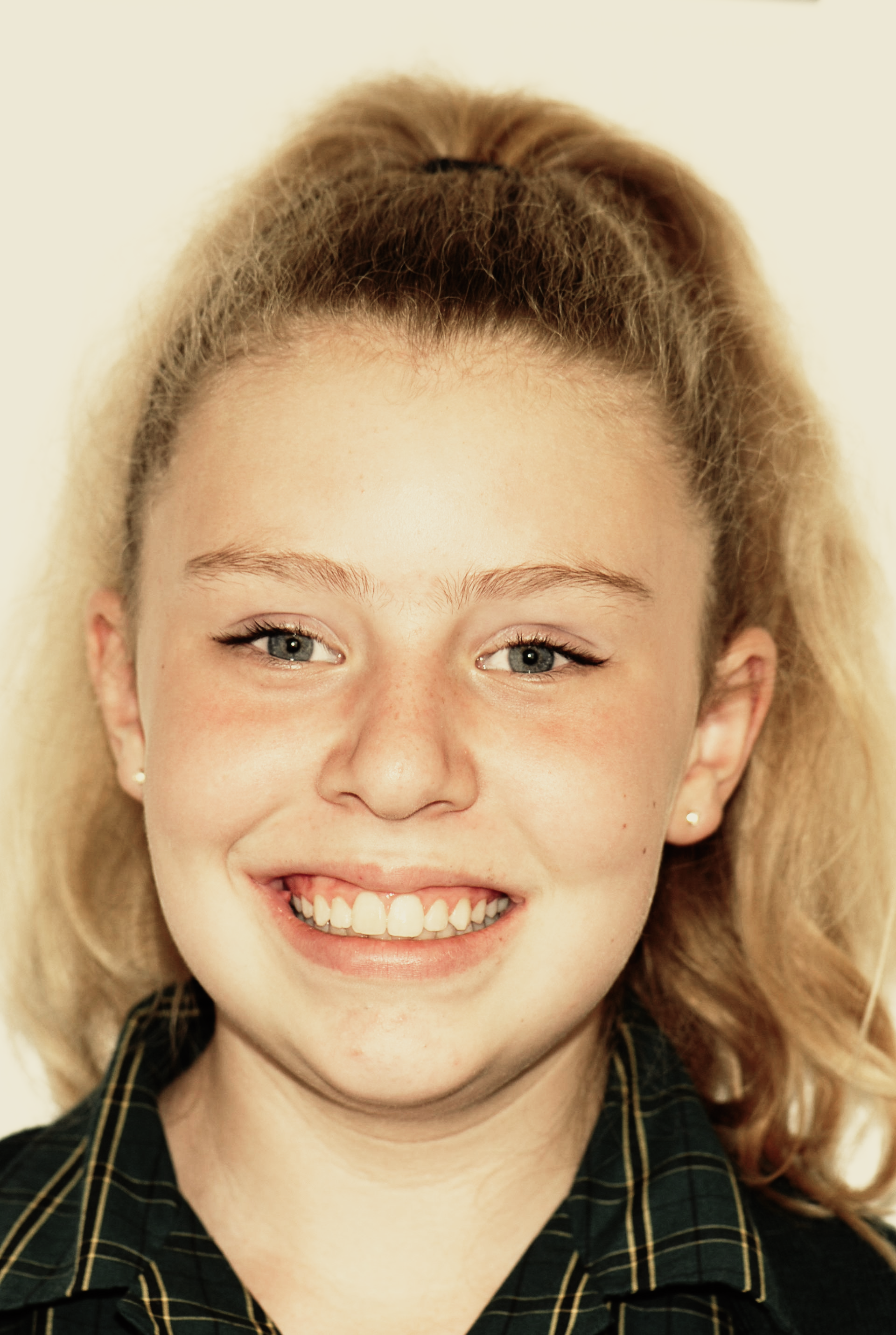 Girl smiling - teeth whitening Christchurch - Duxton Dental