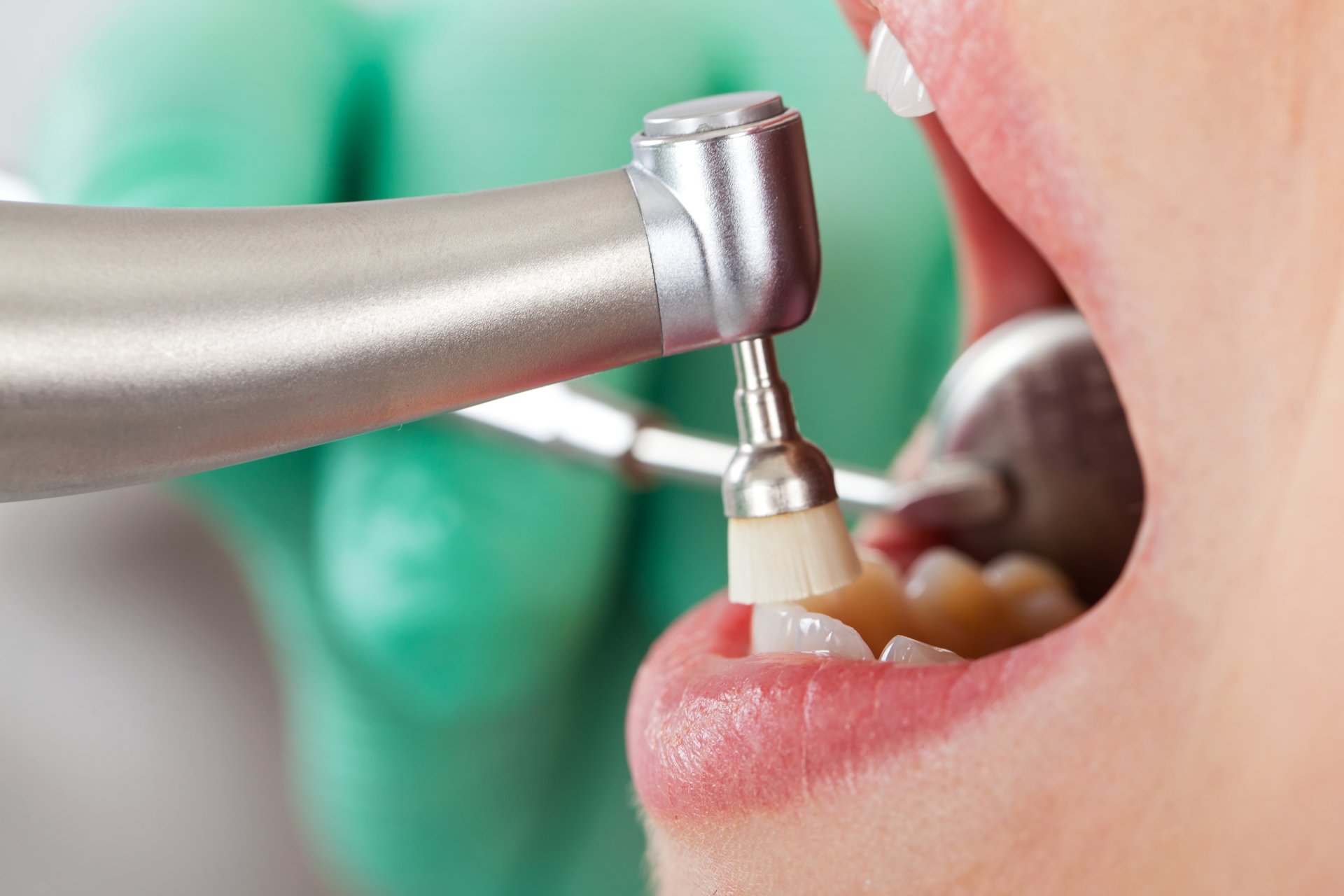 Hygienist cleaning a patients mouth - Duxton Dental - Hygienists Christchurch