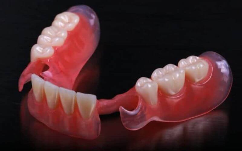 Протезирование зубов | Стоматологическая клиника- Dental Shop