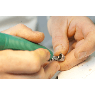 What Is A Soft Reline In Dentures At Raymond Degregorio Blog - Foto 7