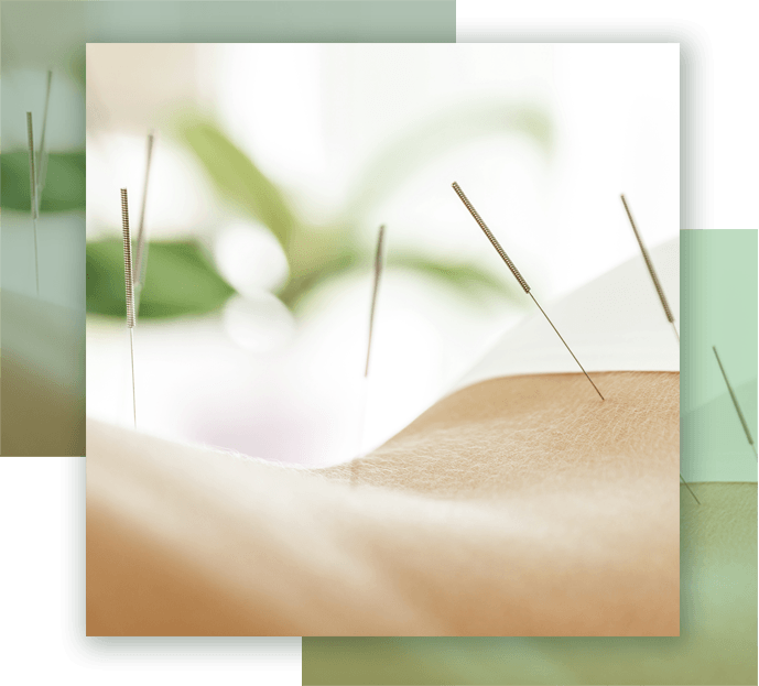 Acupuncture Therapy Licensed Acupuncture Therapists, Smithtown, NY