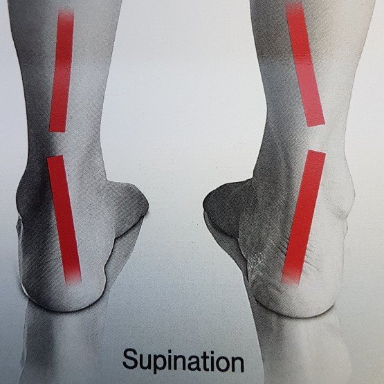 Treatments for bunions Kettering Foot Health Clinic