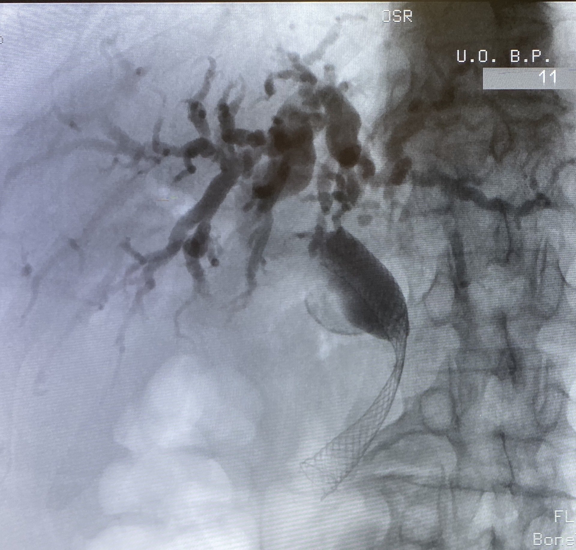 Advanced Endoscopy & Gastroenterology