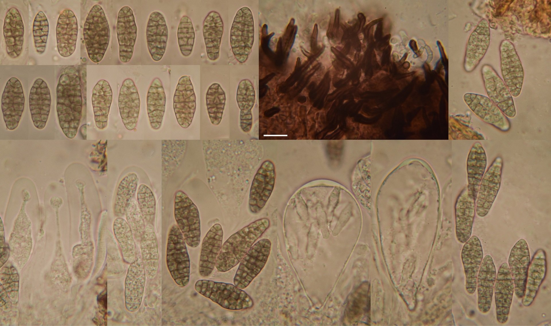 Capronia acutiseta