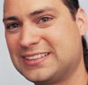 Invisalign patient - manuel