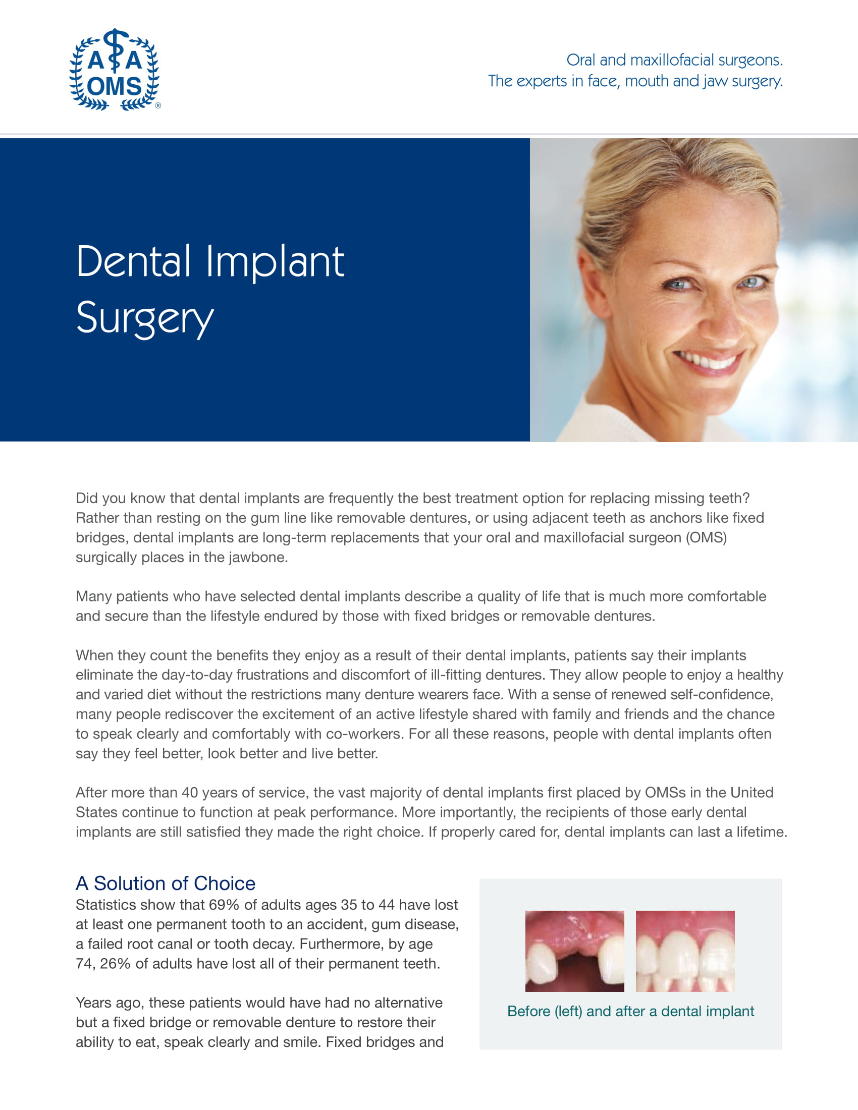 Dental Implant Surgery in Harrisburg, Lititz, & Lancaster, PA