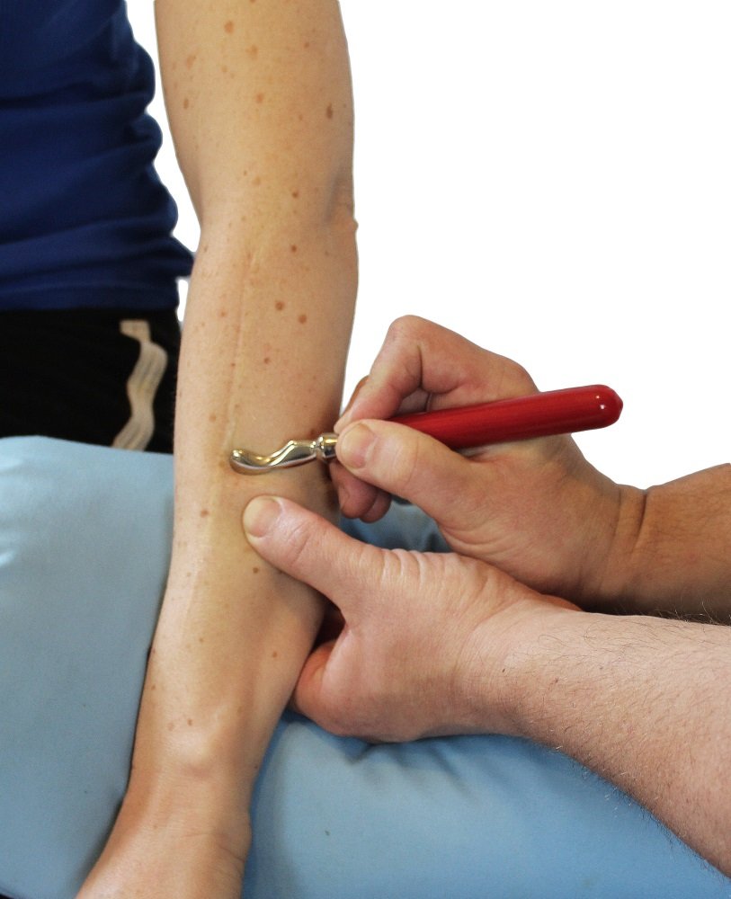 Myobar IASTM tools for health care professionals