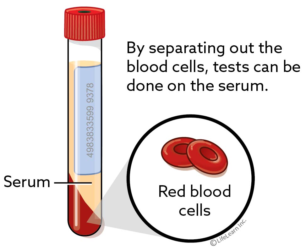 Acetaminophen Toxicity in Cats