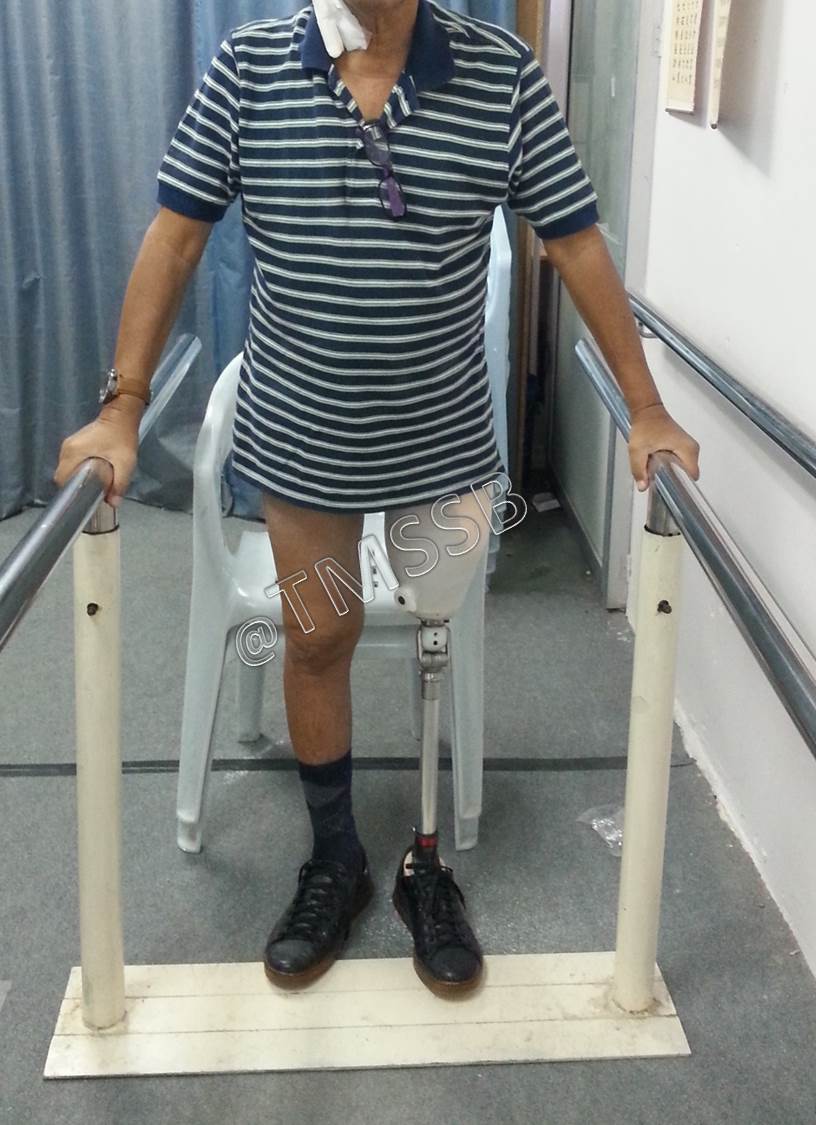 Gallery Total Medical Supplies Sdn Bhd Prosthetic & Orthotic Centre