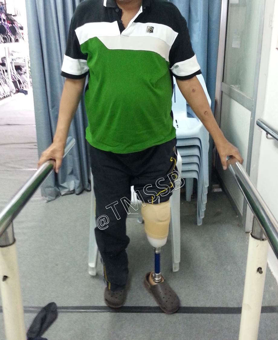 Gallery Total Medical Supplies Sdn Bhd Prosthetic & Orthotic Centre