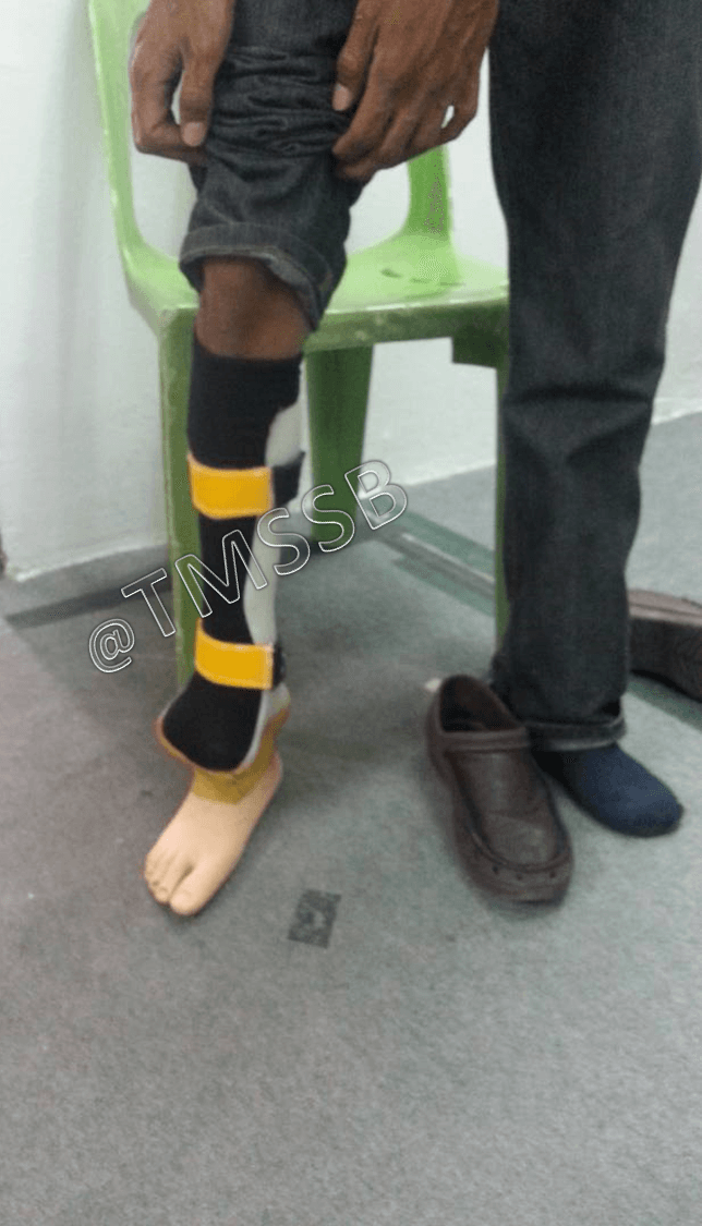 Gallery Total Medical Supplies Sdn Bhd Prosthetic & Orthotic Centre