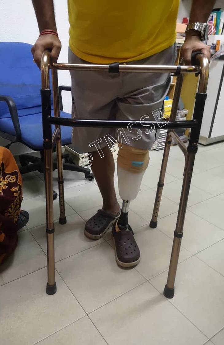 Gallery Total Medical Supplies Sdn Bhd Prosthetic & Orthotic Centre