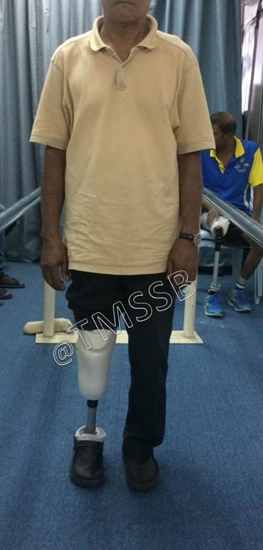 Gallery Total Medical Supplies Sdn Bhd Prosthetic & Orthotic Centre