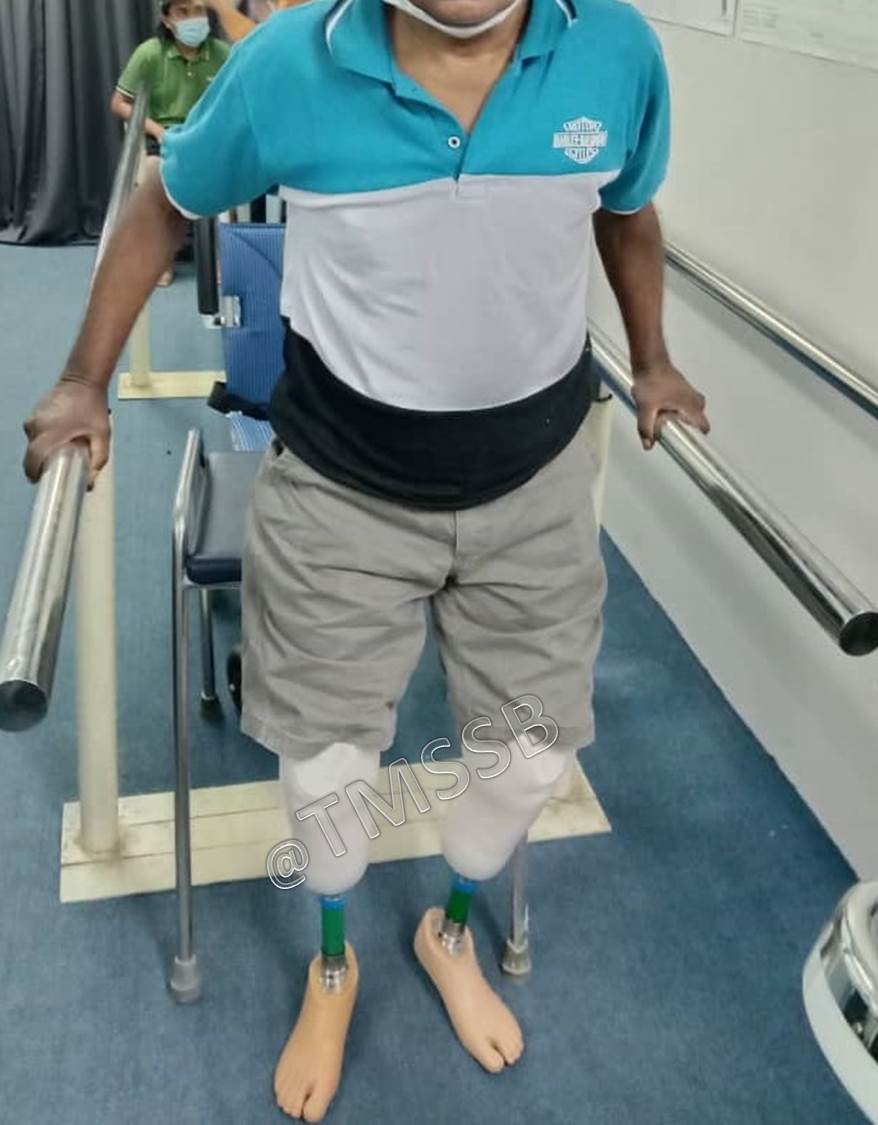 Gallery Total Medical Supplies Sdn Bhd Prosthetic & Orthotic Centre