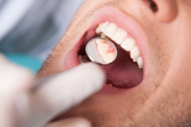 dentist checking teeth