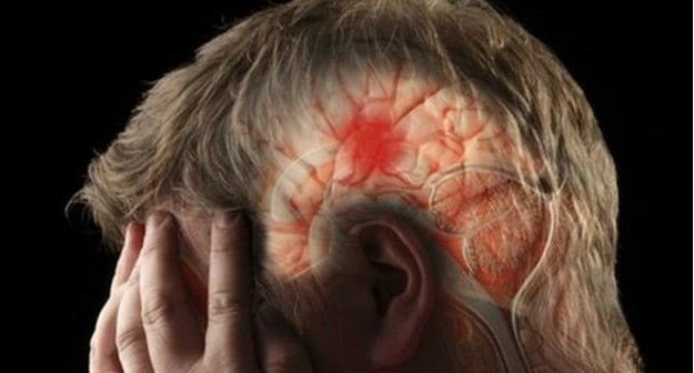 Coágulo un de síntoma el sanguíneo es entumecimiento un