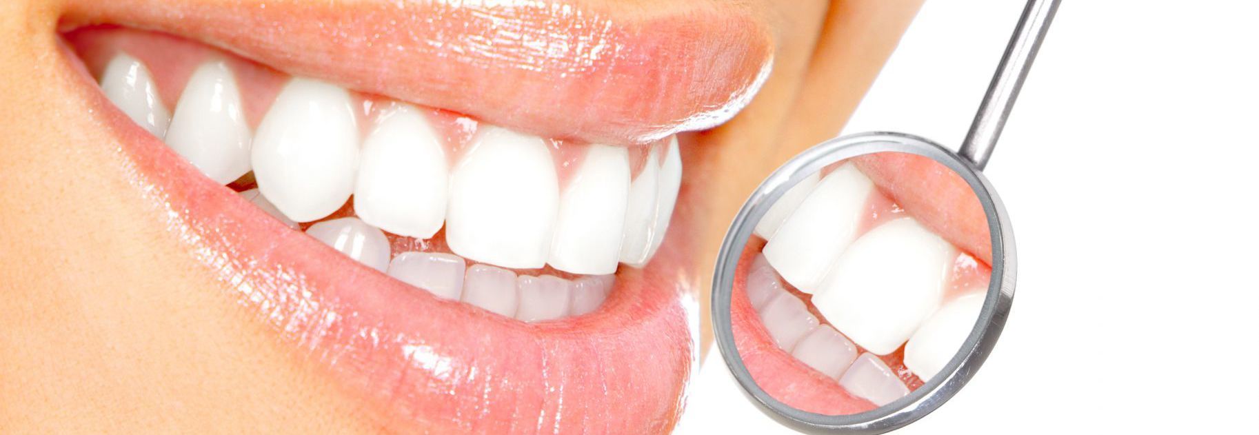 beautiful teeth after a visit to the dental practice in Tauranga