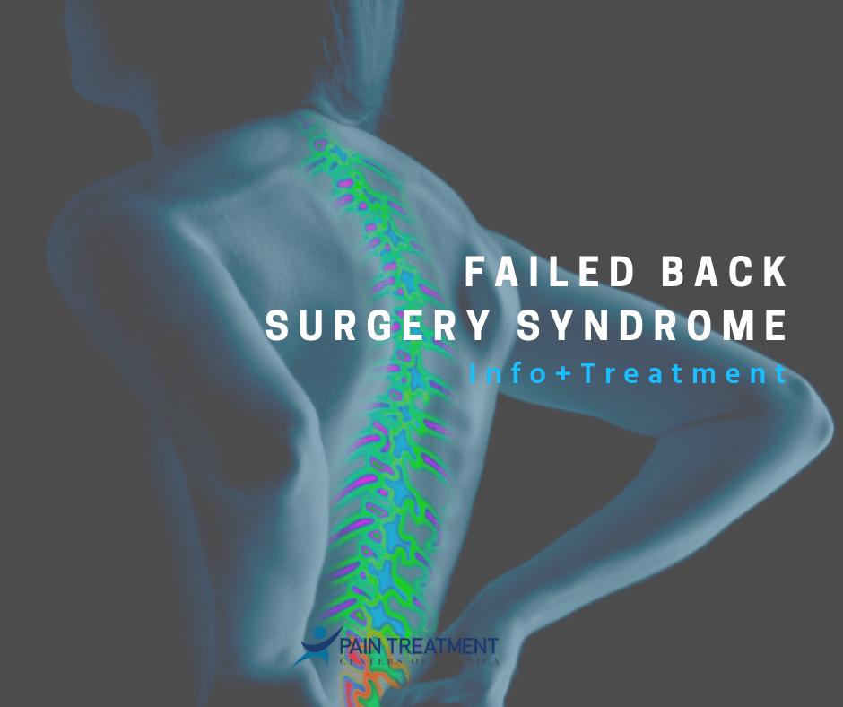 Arthritis Pain What Are The Best Treatment Options?