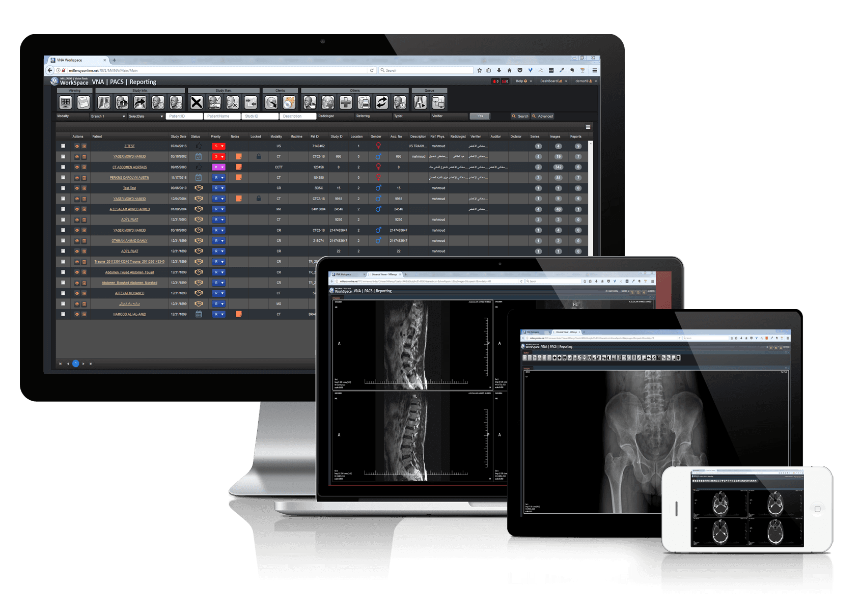 Flat-Panel Digital radiography Systems and Solutions.