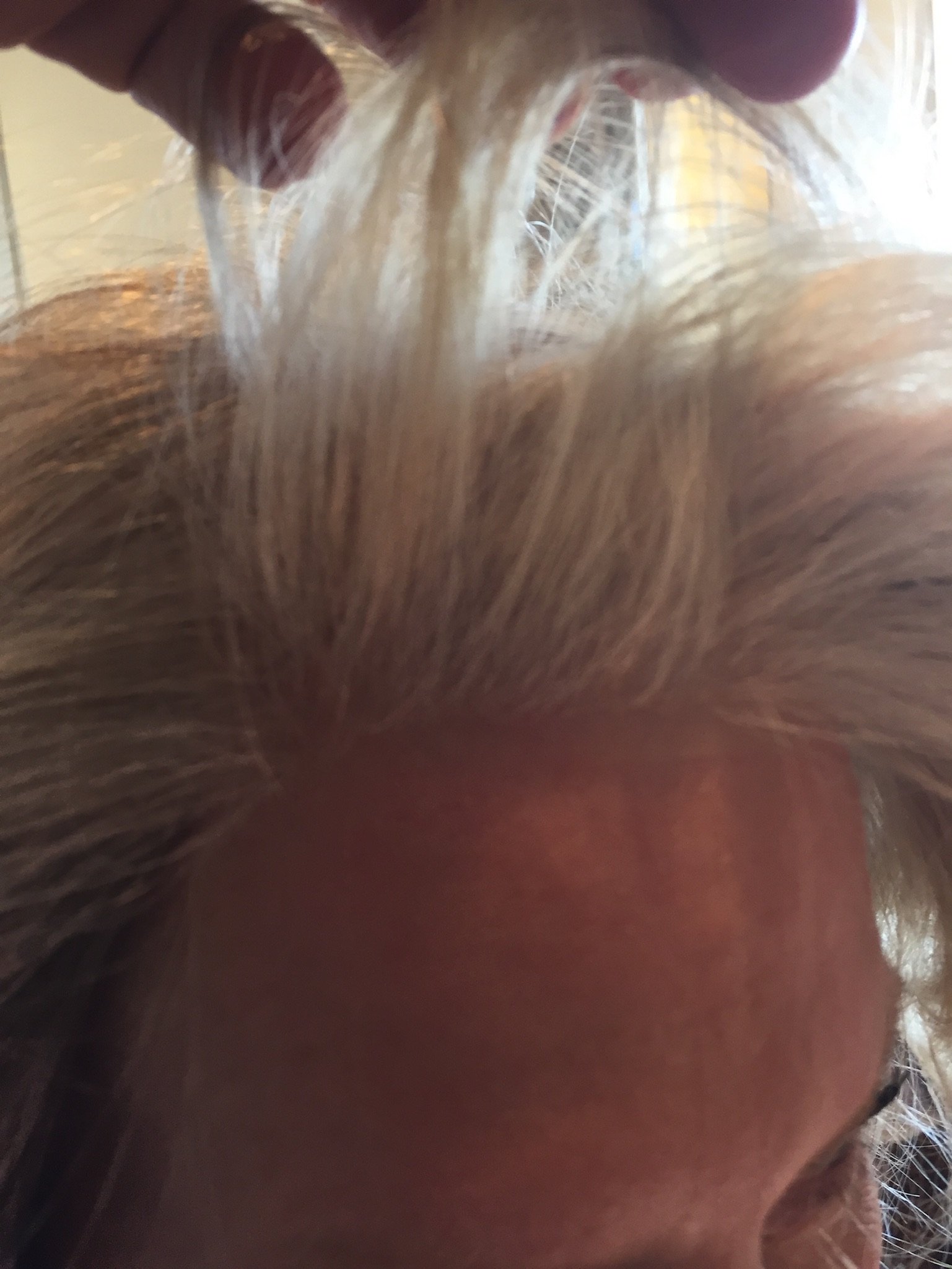 The Wig Gallery Hair Loss Alopecia Balding Tampa Wethersfield
