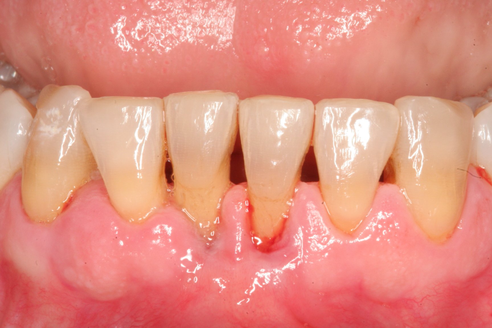 Periodontia