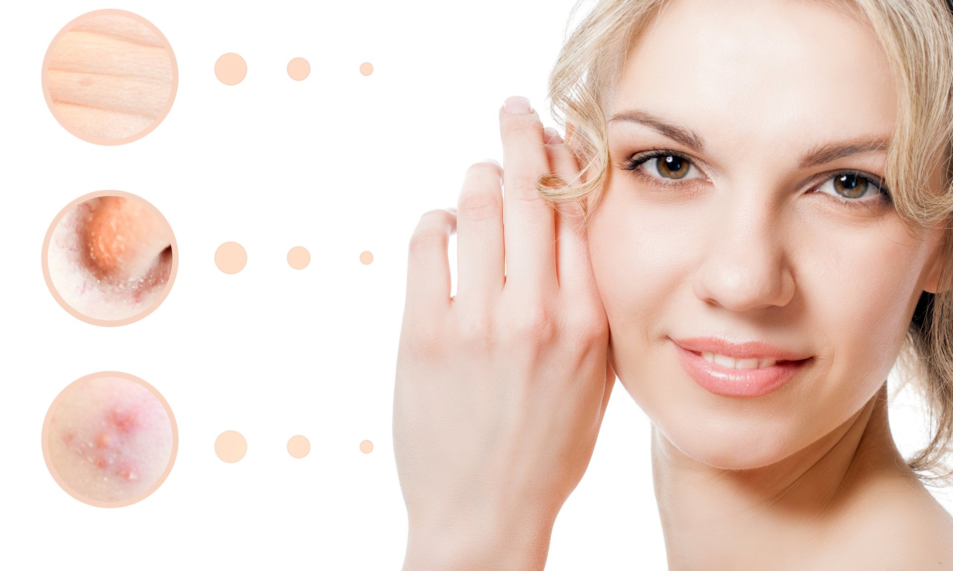 Skin Spa Med Dysport Skin Spa Med Dysport