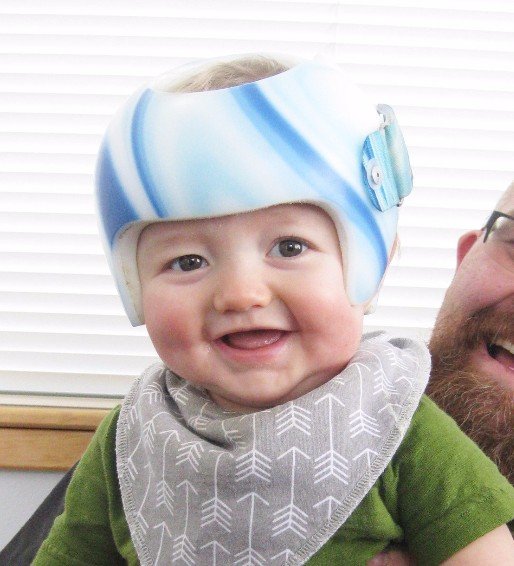 Cranial Remolding Helmets Northern Care Inc., Prosthetics & Orthotics