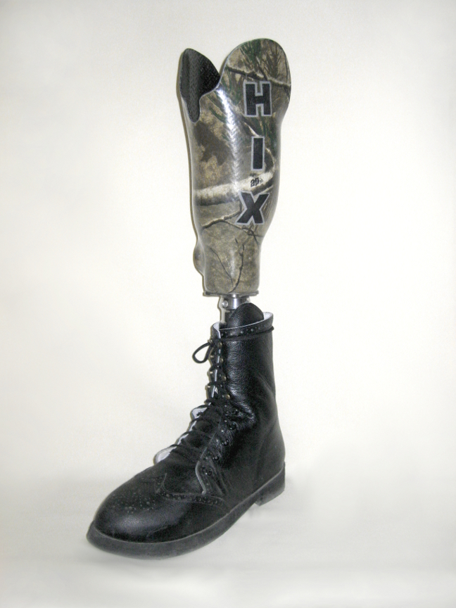 transtibial prothesis transtibial prothesis