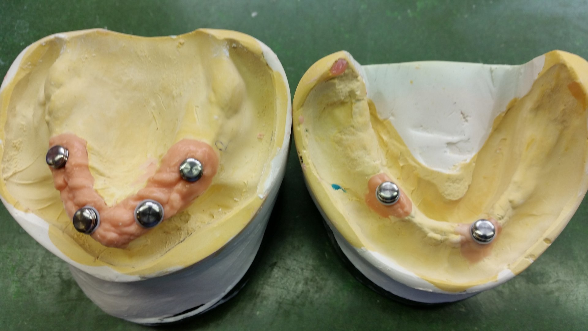 Clinicians services by RDS Denture Laboratory