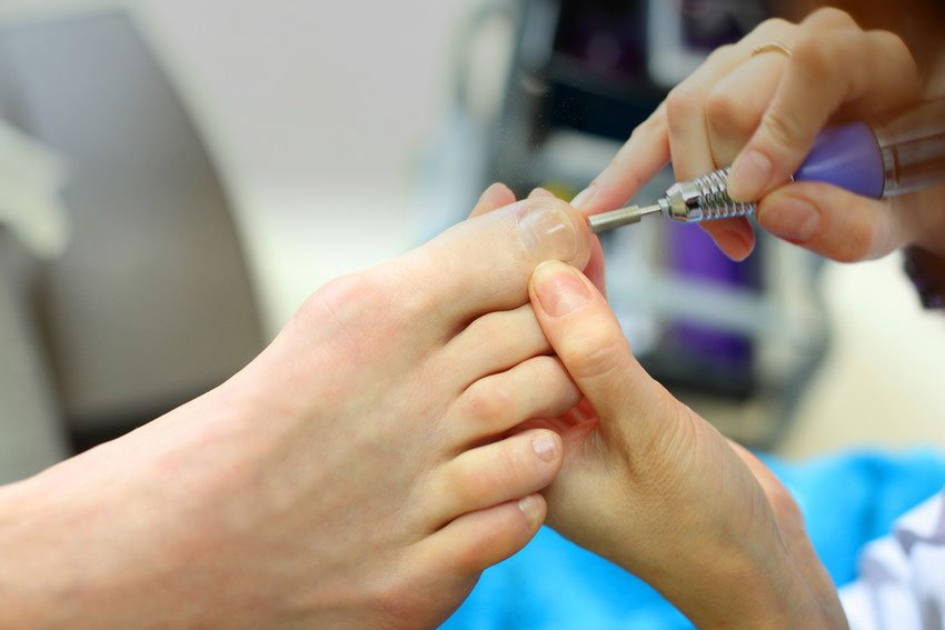 Home Visit Chiropodist Greater London's Chiropodist