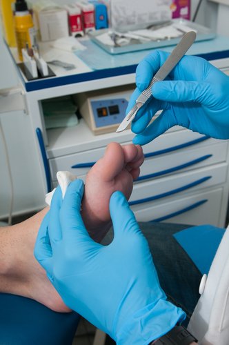 podiatrist with scaple