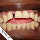 Class2_Profile_Before