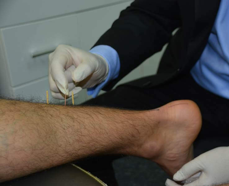 Musculoskeletal/Sports Perth, WA CentrePod Podiatry