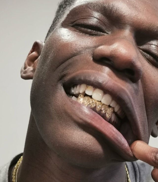 Custom made grillz Leicester Gold Teeth 1st Impressions