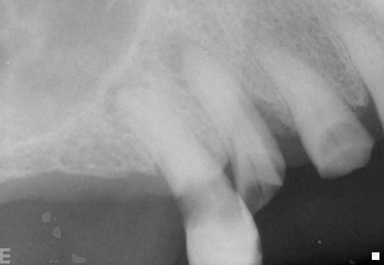 Frequently Asked Dental Questions Sequim, WA Sequim Advanced Dental