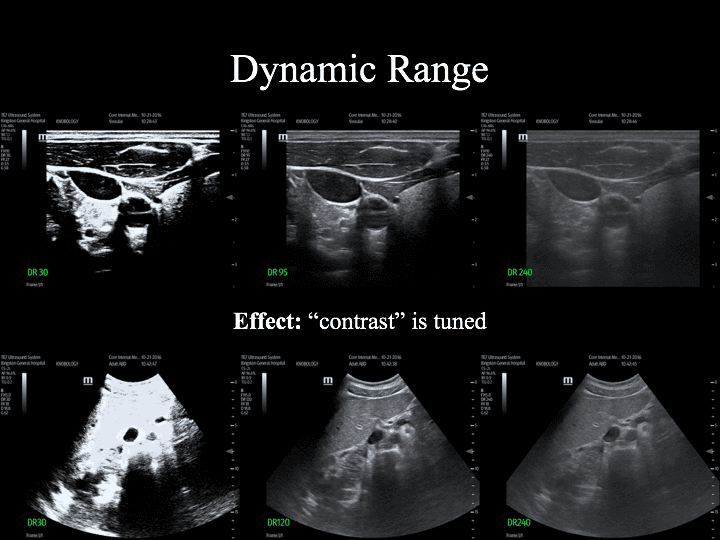 Internal Medicine Point of Care Ultrasound IMPoCUS